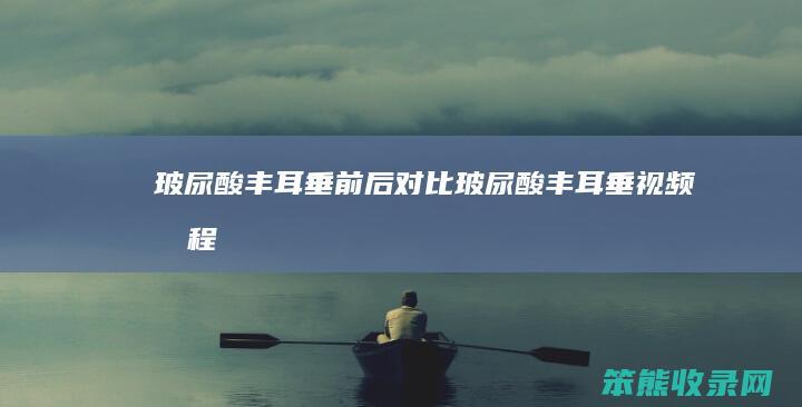 玻尿酸丰耳垂前后玻尿酸丰耳垂视频教程